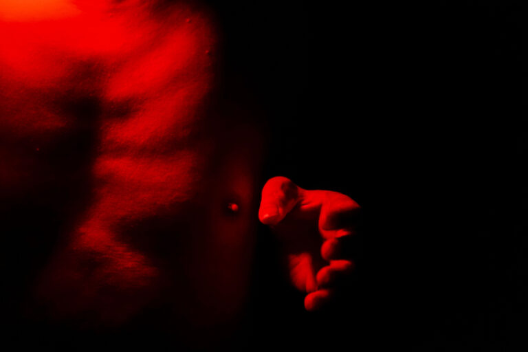 FK_00527